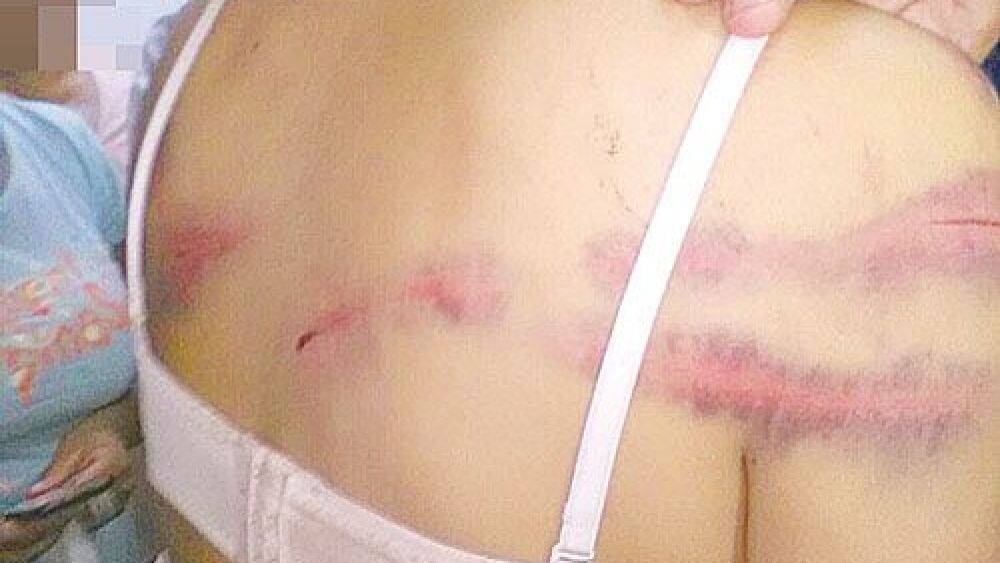 Brutalidad.  La mujer presentaba numerosos golpes y cortes en varias partes del cuerpo.