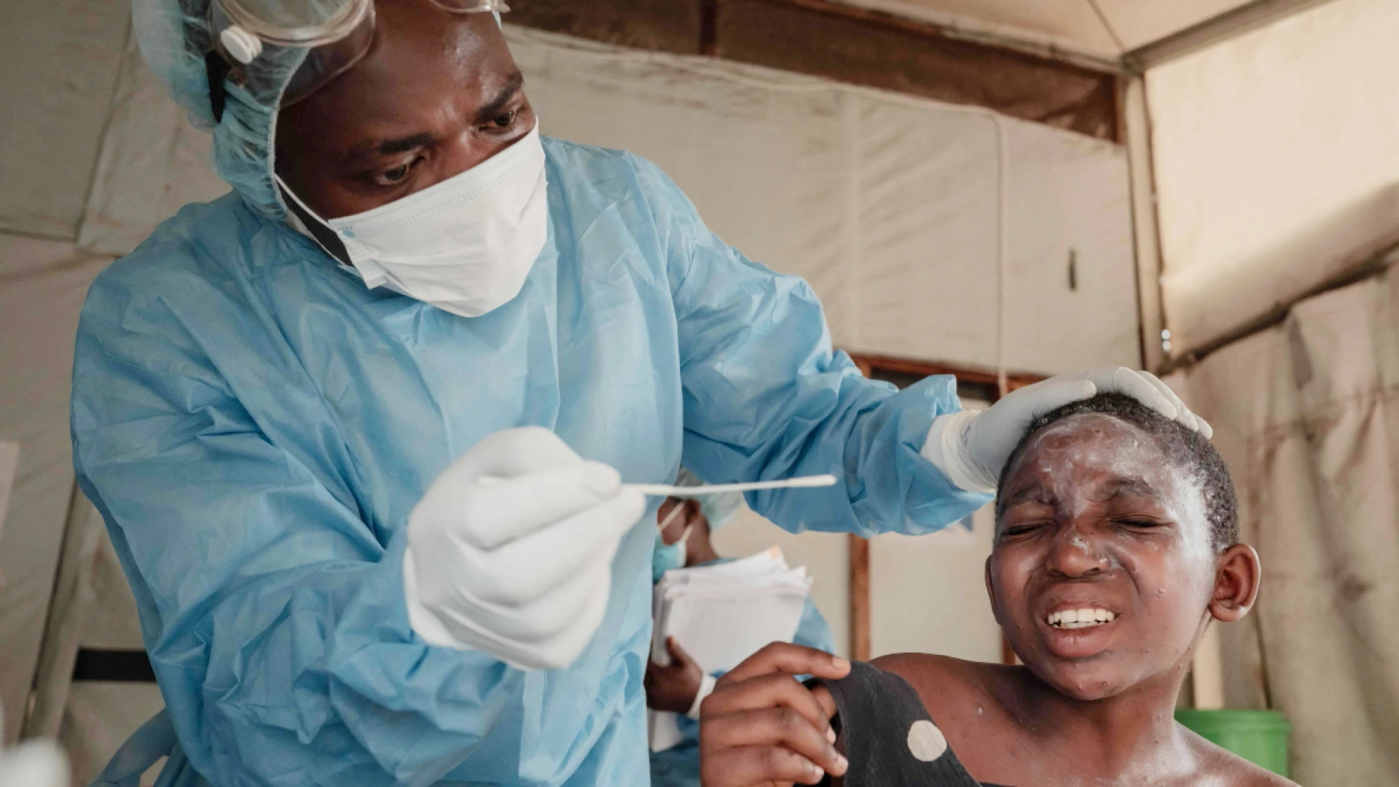Conozca las claves de la renovada crisis sanitaria de mpox en África Conozca las claves de la renovada crisis sanitaria de mpox en África